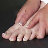 Bunions Callous