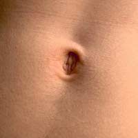 Belly Button Discharge Navel Discharge