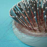 Female Baldness Hair Loss Women Causes
