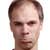 Hair Loss & Thinning