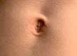 Belly Button Discharge