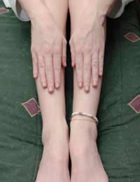 Restless Legs Syndrome Rls Causes